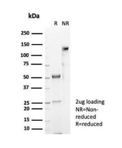 SDS-PAGE analysis of Anti-CD4 Antibody [CD4/7144] under non-reduced and reduced conditions; showing intact IgG and intact heavy and light chains, respectively SDS-PAGE analysis confirms the integrity and purity of the antibody