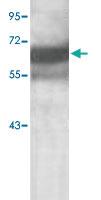 Anti-TGFBI Rabbit Polyclonal Antibody