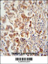 Anti-TEX13B Rabbit Polyclonal Antibody (FITC (Fluorescein Isothiocyanate))