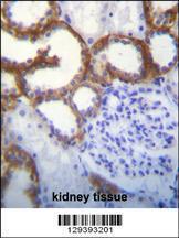 Anti-TMEM150B Rabbit Polyclonal Antibody (Biotin)