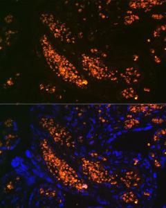 Immunofluorescence analysis of human placenta using Anti-fetal hemoglobin Antibody [ARC1838] (A307354) at a dilution of 1:100 (40X lens). DAPI was used to stain the cell nuclei (blue)