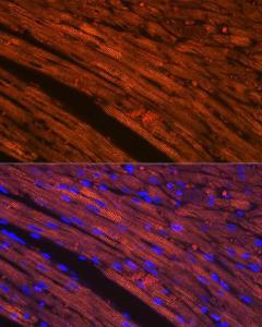 Immunofluorescence analysis of rat heart using Anti-Cardiac Troponin T Antibody [ARC1242] (A308336) at a dilution of 1:100 (40x lens). DAPI was used to stain the cell nuclei (blue).