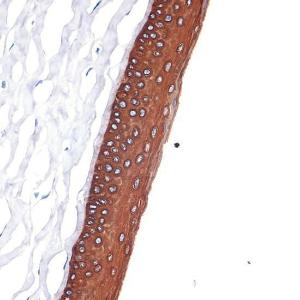 Immunohistochemistry analysis of paraffin-embedded rat cornea using Anti-Keratin 12 / K12 Antibody [ARC2465] (A305758) at a dilution of 1:100 (40x lens). Perform microwave antigen retrieval with 10 mM Tris/EDTA buffer pH 9.0 before commencing with IHC staining protocol.