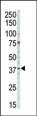 Anti-CSNK1A1 Rabbit Polyclonal Antibody