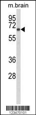 Anti-DAB1 Rabbit Polyclonal Antibody