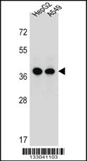 Anti-ERLIN1 Rabbit Polyclonal Antibody