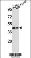 Anti-GSDMB Rabbit Polyclonal Antibody (AP (Alkaline Phosphatase))