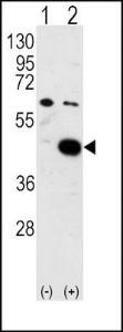 Anti-PDK2 Rabbit Polyclonal Antibody