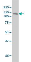 Anti-LAMB3 Mouse Monoclonal Antibody [clone: 2G10]