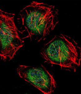 Anti-CNOT7 Rabbit Polyclonal Antibody (HRP (Horseradish Peroxidase))