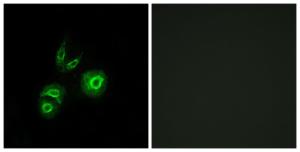 Immunofluorescence analysis of A549 cells using Anti-MET Antibody. The right hand panel represents a negative control, where the antibody was pre-incubated with the immunising peptide