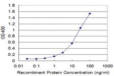 Anti-PPOX Mouse Monoclonal Antibody [clone: 1E1]