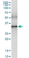 Anti-EXOSC3 Rabbit Polyclonal Antibody