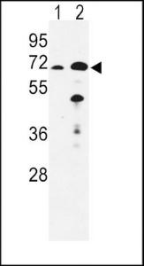 Anti-EHHADH Rabbit Polyclonal Antibody (AP (Alkaline Phosphatase))