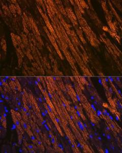 Immunofluorescence analysis of mouse heart using Anti-Cardiac Troponin T Antibody [ARC1242] (A308336) at a dilution of 1:100 (40x lens). DAPI was used to stain the cell nuclei (blue).