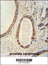 Anti-TMEM214 Rabbit Polyclonal Antibody