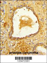 Anti-DAB2 Rabbit Polyclonal Antibody