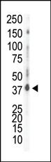 Anti-CSNK1D Rabbit Polyclonal Antibody