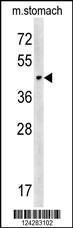 Anti-CHST14 Rabbit Polyclonal Antibody (Biotin)