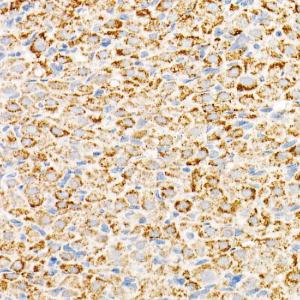 Immunohistochemistry analysis of paraffin-embedded human lung using Anti-mtTFA Antibody [ARC51776] (A14389) at a dilution of 1:200 (40x lens) Perform high pressure antigen retrieval with 10 mM citrate buffer pH 60 before commencing with IHC staining protocol