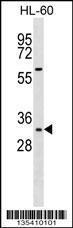 Anti-HOXB13 Rabbit Polyclonal Antibody (AP (Alkaline Phosphatase))