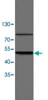 Anti-TNFRSF1A Rabbit Polyclonal Antibody