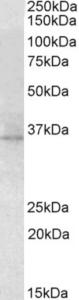 EB10078 (2 µg/ml) staining of Mouse Eye lysate (35 µg protein in RIPA buffer). Primary incubation was 1 hour. Detected by chemiluminescence.