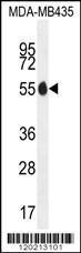 Anti-PAX1 Rabbit Polyclonal Antibody (APC (Allophycocyanin))