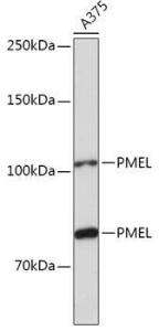 Anti-Melanoma gp100 Rabbit Polyclonal Antibody