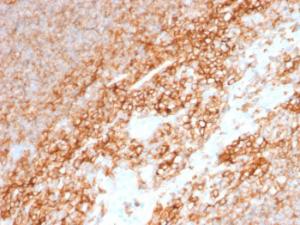 Immunohistochemical analysis of formalin-fixed, paraffin-embedded human tonsil using Anti-CD44 Antibody [BU75]