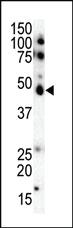 Anti-CSNK1E Rabbit Polyclonal Antibody