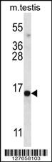 Anti-SPATA19 Rabbit Polyclonal Antibody