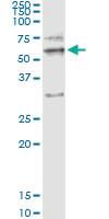 Anti-MMP12 Polyclonal Antibody Pair