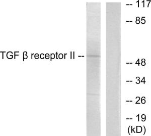 Western blot analysis of lysates from HepG2 (65K) cells using Anti-TGF beta Receptor II Antibody. The right hand lane represents a negative control, where the antibody is blocked by the immunising peptide