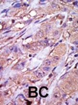 Anti-CSNK1E Rabbit Polyclonal Antibody