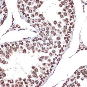 Anti-HMGB2 Rabbit Monoclonal Antibody [clone: ARC1460]