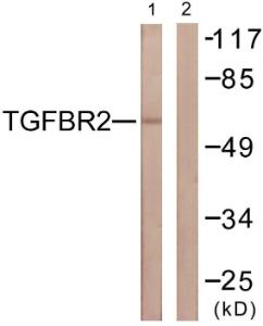 Western blot analysis of lysates from NIH/3T3 cells using Anti-TGF beta Receptor II Antibody. The right hand lane represents a negative control, where the Antibody is blocked by the immunising peptide