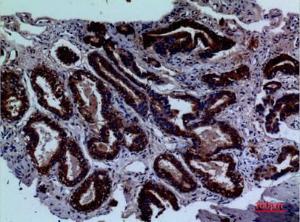 Immunohistochemical analysis of paraffin-embedded human prostate cancer using Anti-LY9 Antibody