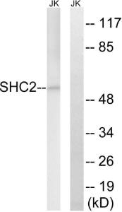 Western blot analysis of lysates from Jurkat cells using Anti-SHC2 Antibody. The right hand lane represents a negative control, where the antibody is blocked by the immunising peptide