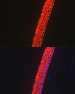 Immunofluorescence analysis of mouse eye using Anti-Keratin 12 / K12 Antibody [ARC2465] (A305758) at a dilution of 1:100. DAPI was used to stain the cell nuclei (blue).