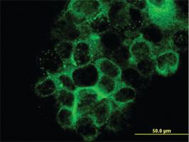 Anti-LAMB3 Mouse Monoclonal Antibody [clone: 2G10]