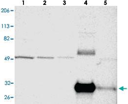 Anti-MBL2 Rabbit Polyclonal Antibody