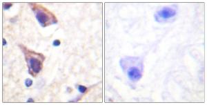 Immunohistochemical analysis of paraffin-embedded human brain tissue using Anti-TGF beta Receptor II Antibody. The right hand panel represents a negative control, where the Antibody was pre-incubated with the immunising peptide