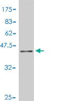 Anti-ZNF148 Mouse Polyclonal Antibody