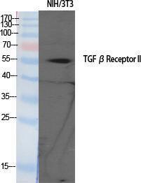 Western blot analysis of various cells using Anti-TGF beta Receptor II Antibody