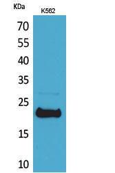 Western blot analysis of K562 cells using Anti-LIF Antibody