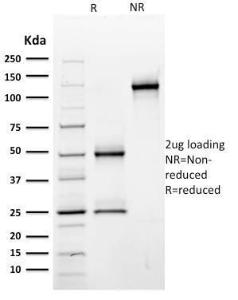 SDS-PAGE analysis of Anti-CD44 Antibody [BU75] under non-reduced and reduced conditions; showing intact IgG and intact heavy and light chains, respectively. SDS-PAGE analysis confirms the integrity and purity of the antibody.