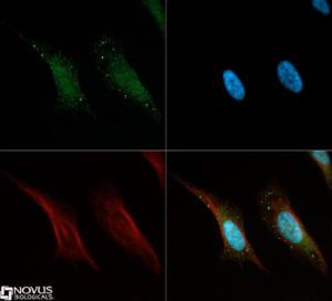 Anti-TARDBP Rabbit Polyclonal Antibody