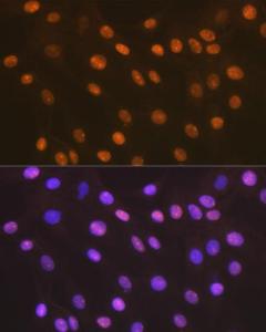 Anti-HMGB2 Rabbit Monoclonal Antibody [clone: ARC1460]