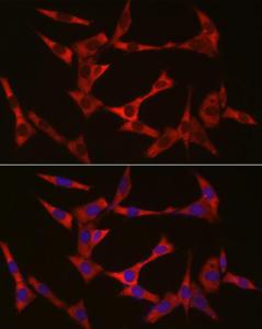 Anti-WIF1 Rabbit Polyclonal Antibody